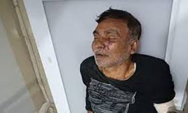 আ.লীগ নেতাকে বিদ্যুতের খুঁটিতে বেঁধে নির্যাতন, হাসপাতালে ভর্তি